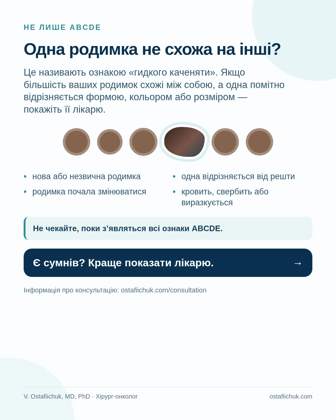 Ознака «гидкого каченяти»: одна родимка помітно відрізняється від інших