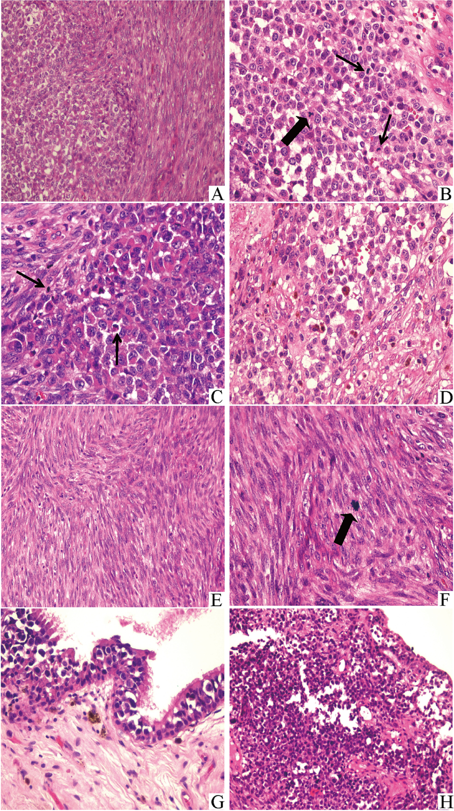 Histology of sinonasal melanoma